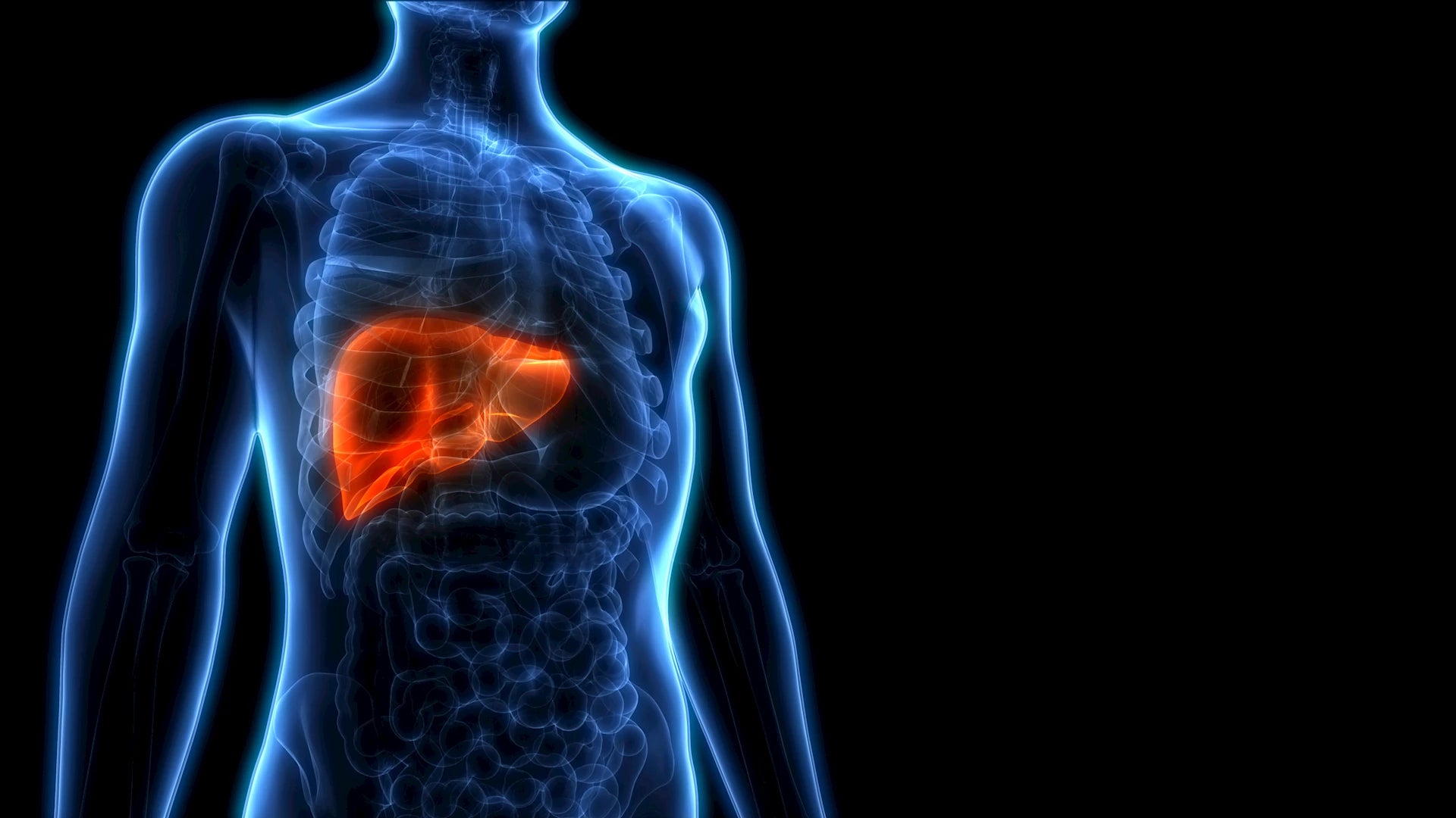 Chemosaturation Treatment in Turkey