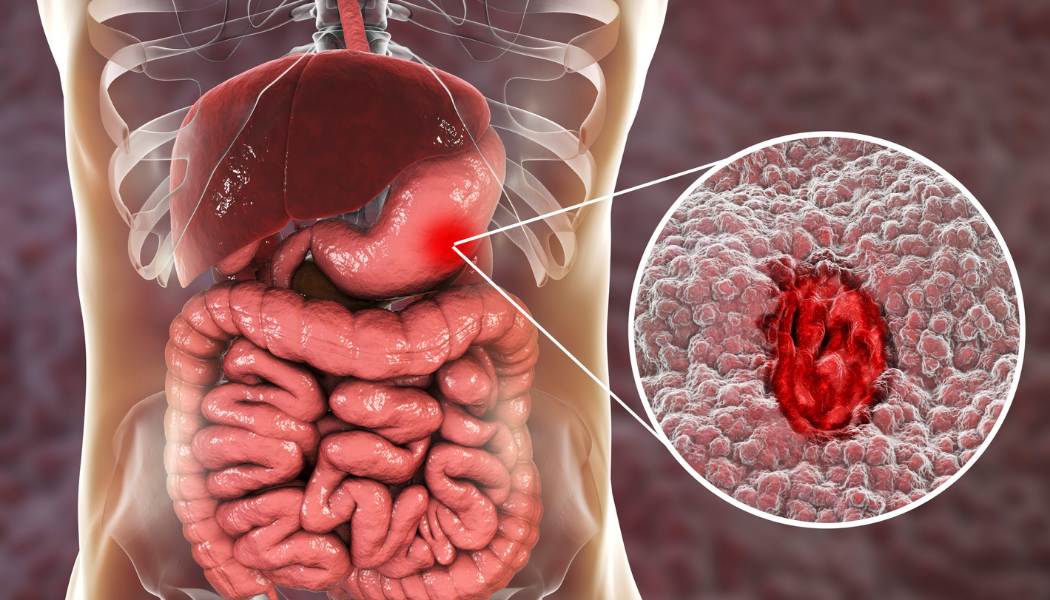Gastrointestinal-System-turkey-fibemed-healthcare