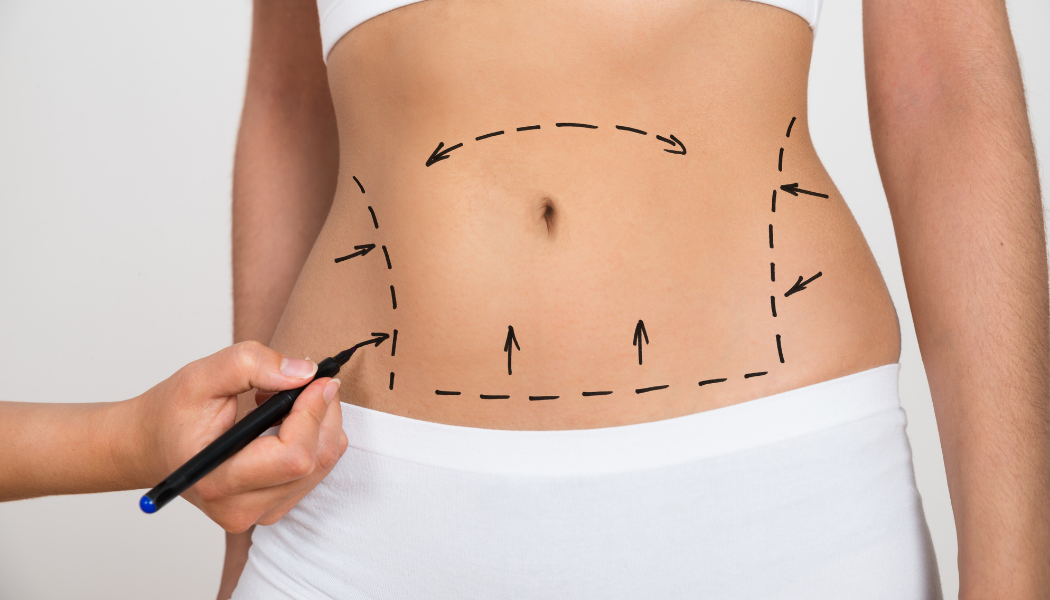 Plastic-Surgery-turkey-fibemed-healthcare