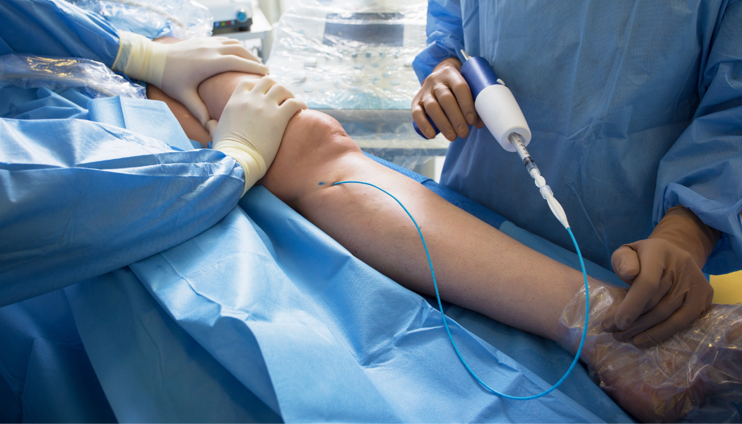 Vascular-Surgery-turkey-fibemed-healthcare