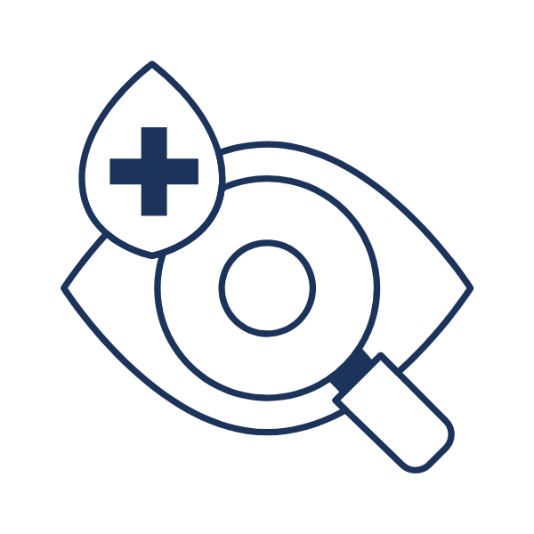 Laser (SLT) Eye Surgery in Turkey Fibemed Healthcare